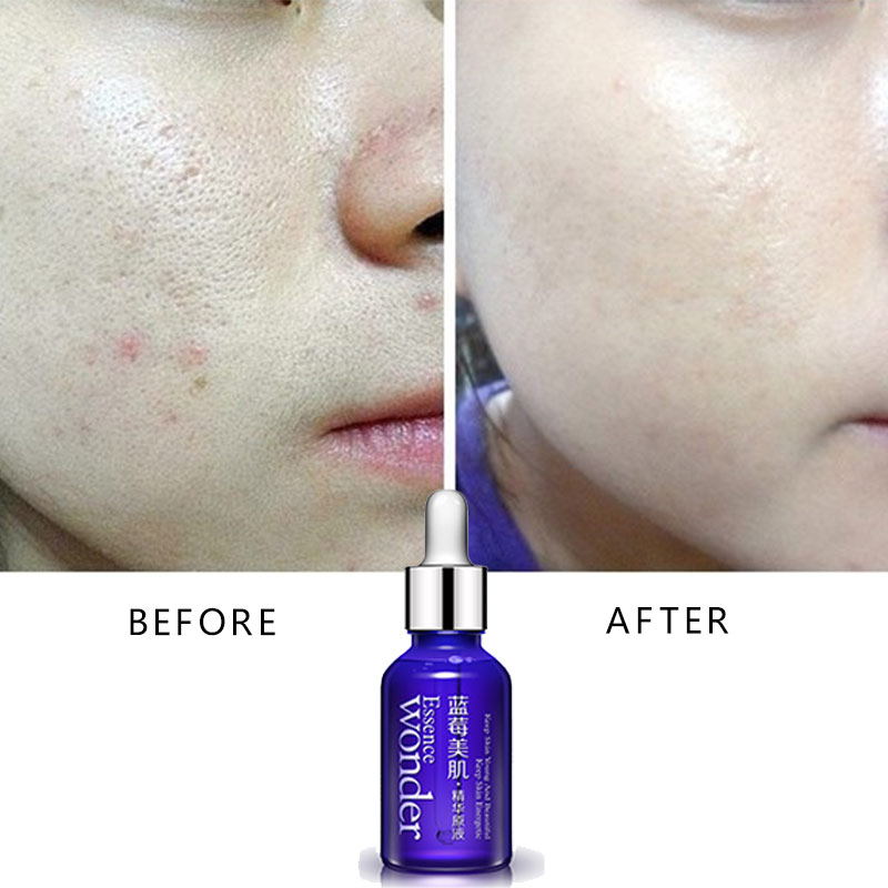 BIOAQUA – sérum de Lifting du  - Skincare Garnier avis et prix