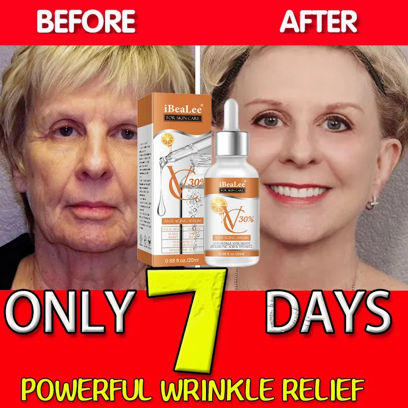 Sérum 30% vitamine C pour le v - Skincare Garnier avis et prix